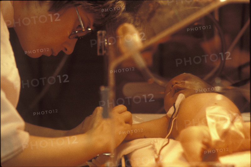 Care of a premature baby, neonatology 1982