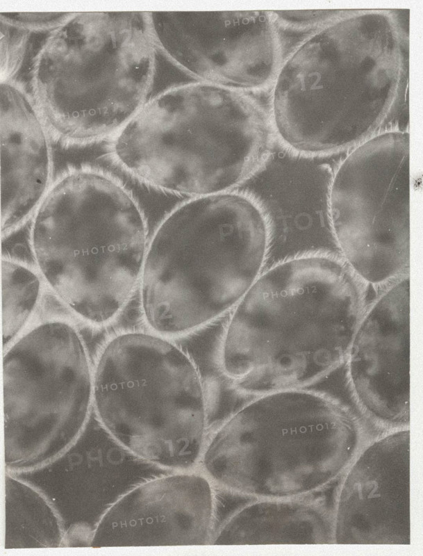 Ostracods