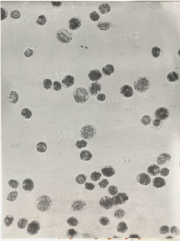 Glenodinium sanguineum