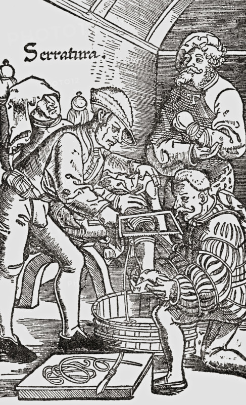 Sixteenth century amputation.