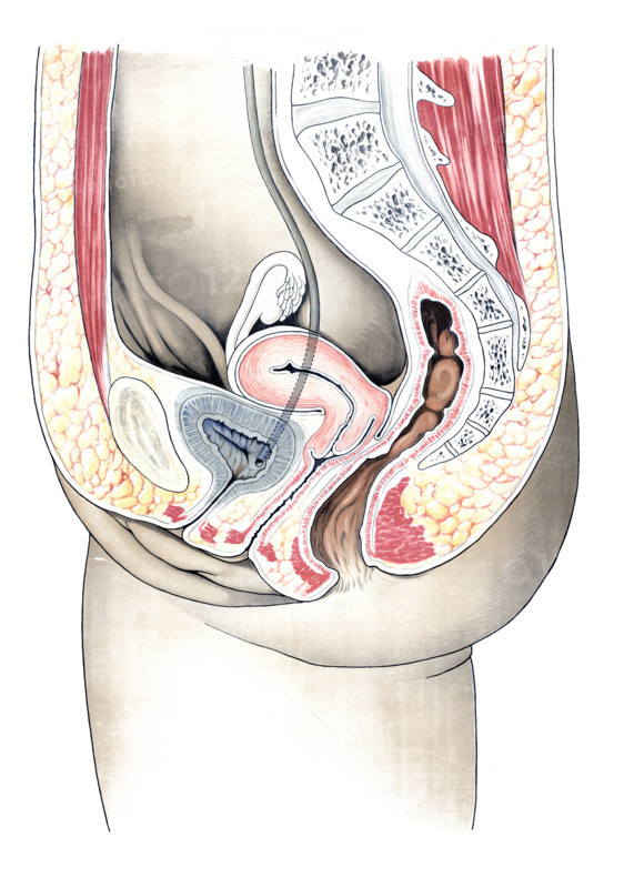 Anatomy, human, schematic representation of the female genitalia, reproduction of a historical school picture, mural or teaching chart, authentic, exact date unknown.