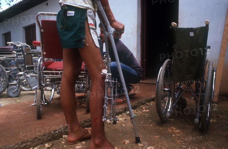 CUBA, Farabundomarti, Amputees centre. Man with pin in leg with wheel chairs all around him