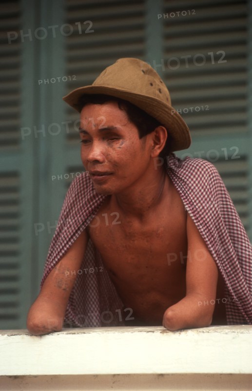 CAMBODIA, Health, War wounded  amputee man at centre for disabled veterans.
