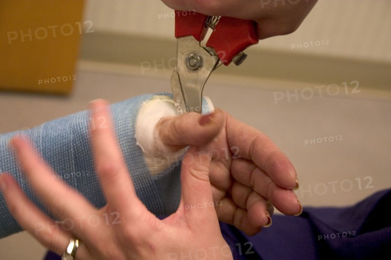USA, Minnesota, Plymouth, Clinic nurse making adjustments to cast with cutter for patient with a broken wrist.