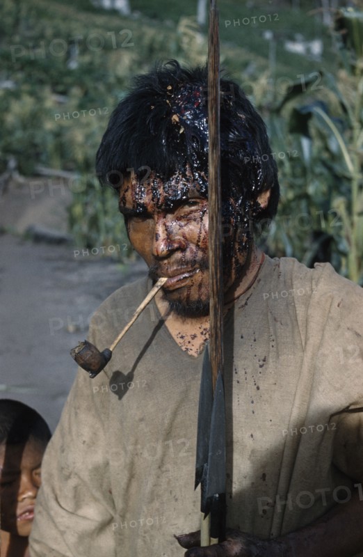 COLOMBIA, Sierra de Perija, Yuko - Motilon ., "Victim after a ritual bow fight in which aim is to hit the opponent’s head. Blood, now dried, has streamed from wound. Clutches his hard  “macana” wood bow and quiver of arrows, smoking a clay pipe"