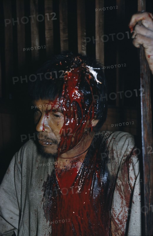 COLOMBIA, Sierra de Perija, Yuko - Motilon ., Victim of bow fight with recent deep wound to skull
