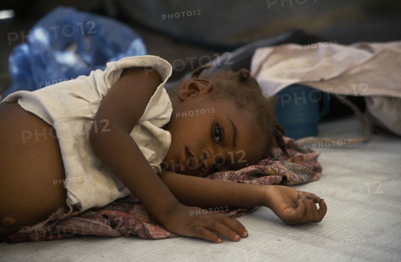 ZAMBIA, Mayukwayukwa Camp, Child lying on mattress in day feeding centre for malnourished children in camp for Angolan refugees.