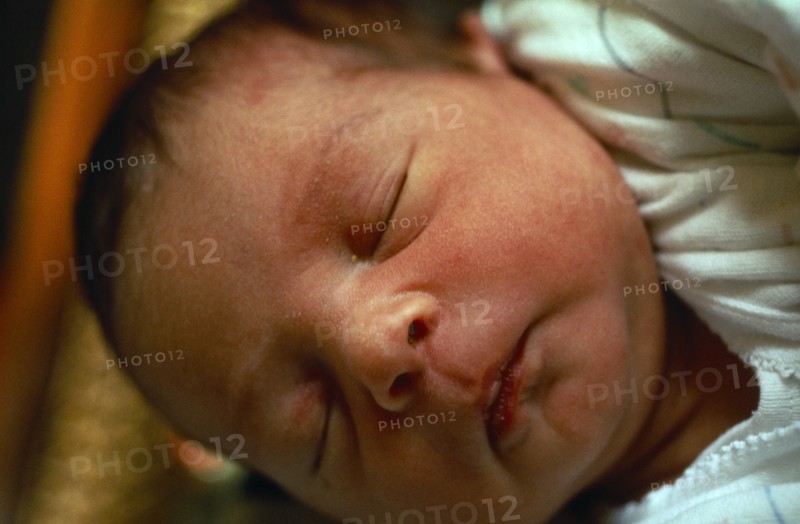 Children, Babies, New Born, Five day old babygirl with puffy eyelids.