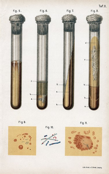5:Pneumonia culture