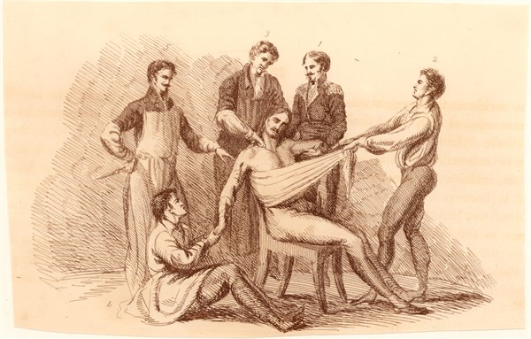 Surgeon and his assistants, before the introduction of anaesthetics