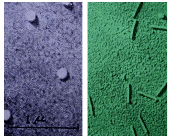 Influenza virus taken through a microscope