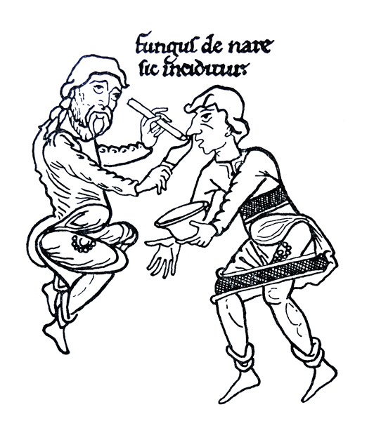 Drawing of the mediaeval treatment of a nasal affliction