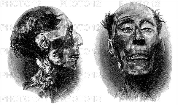 Mummy of Ramses II