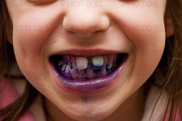 Child using disclosing tablets to show plaque on teeth