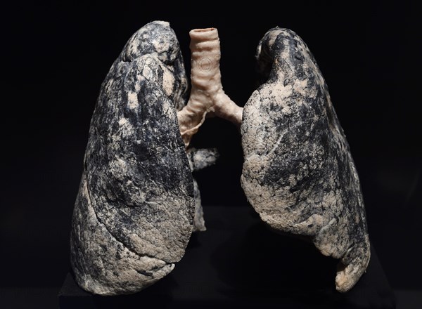 Plastinate
