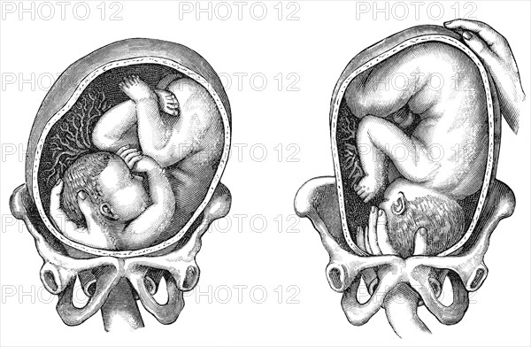 Parturition