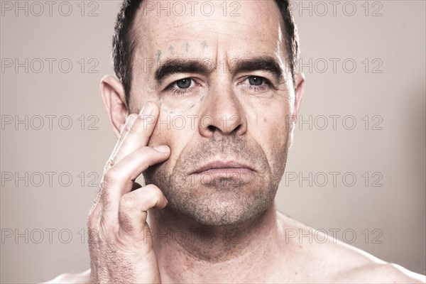Man with markings for plastic surgery on his face