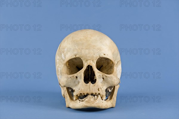 Human skull