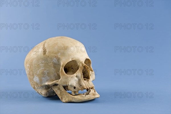 Human skull