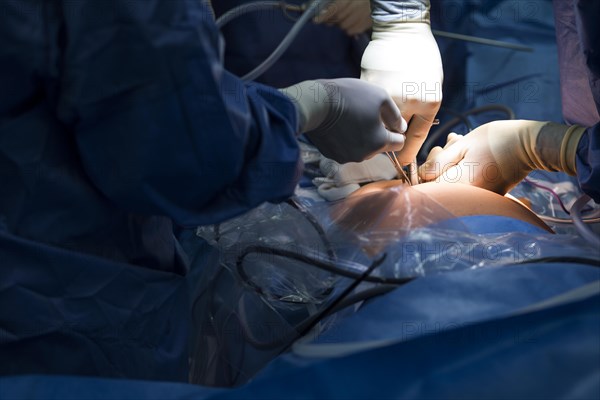Abdominal surgery in a hospital