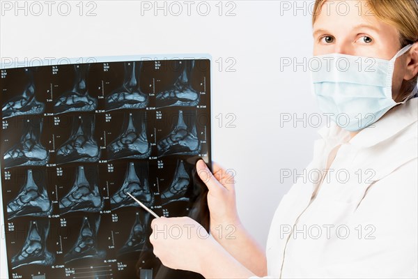 Doctor points to X-ray image