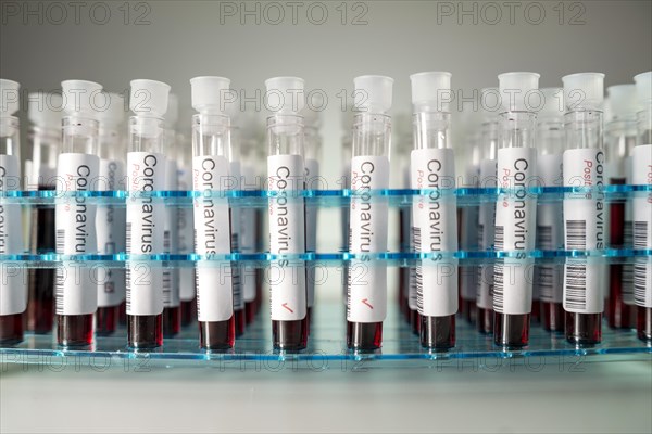 Positive results of corona virus tests