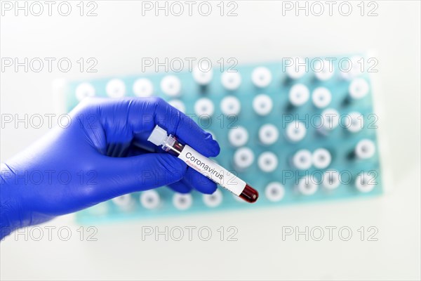 Laboratory physician holding a test tube with positive results of the coronavirus test