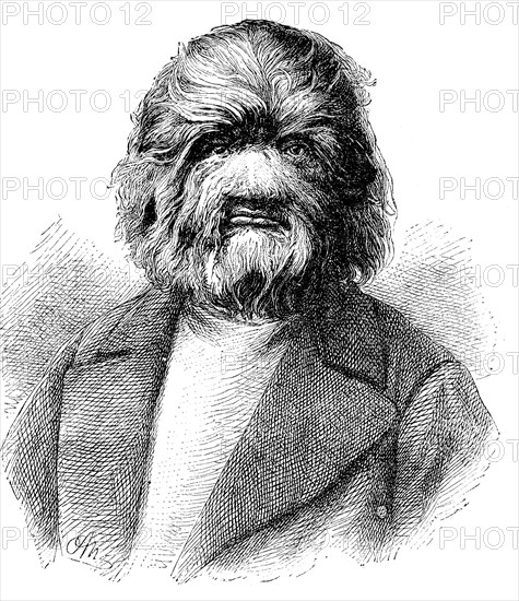 Dog-Faced Man