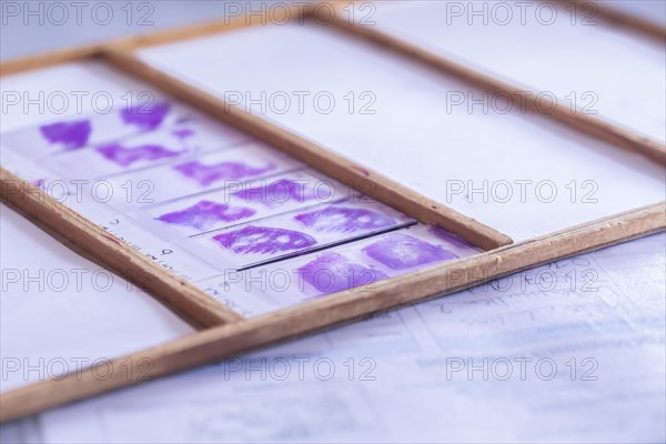 Histological preparations in the laboratory with protocol