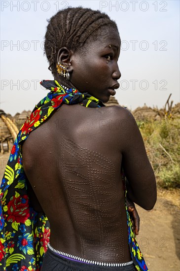 Scar face and body as a mark of beauty woman