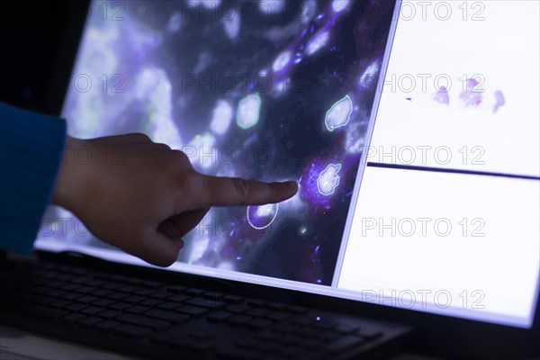 Sample evaluation on the monitor in a histology laboratory