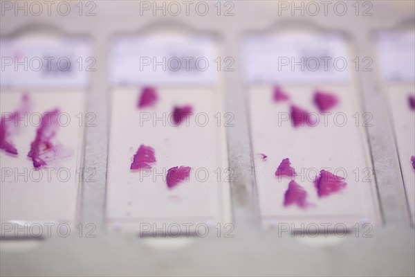 Embedded samples in a histology laboratory