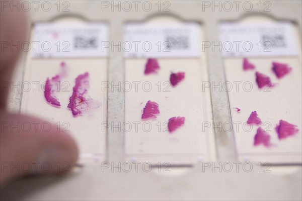 Embedded samples in a histology laboratory