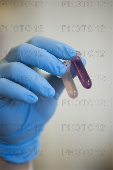 Medical laboratory assistant holding 2 reaction vessels with samples