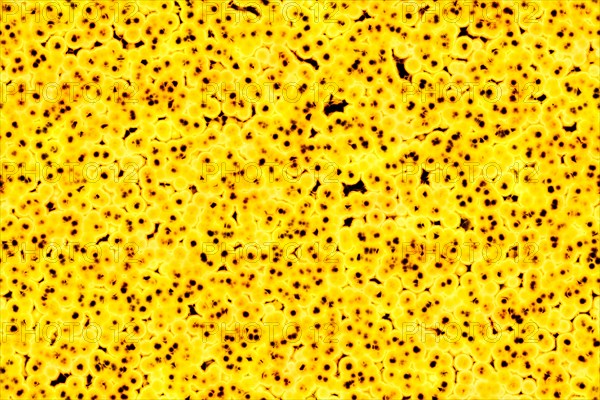 Shape of bacterial cell: cocci
