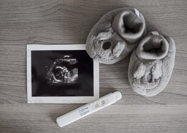 Cute little shoes x ray photo