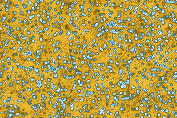 Shape of bacterial cell: cocci