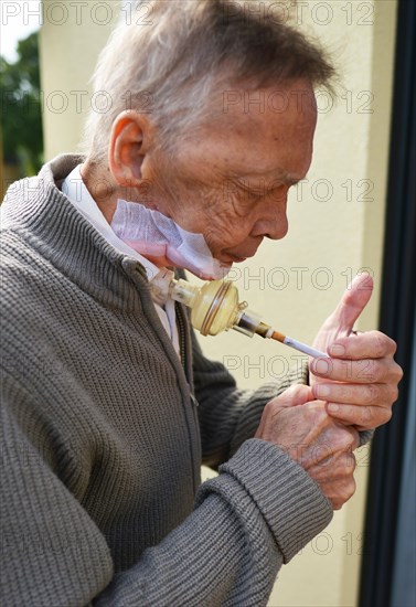 The Mother Theresa Hospice offers its guests a dignified home in a new friendly ambience for patients in their last phase of life. This patient with carcinoma of the floor of the mouth caused by smoki...