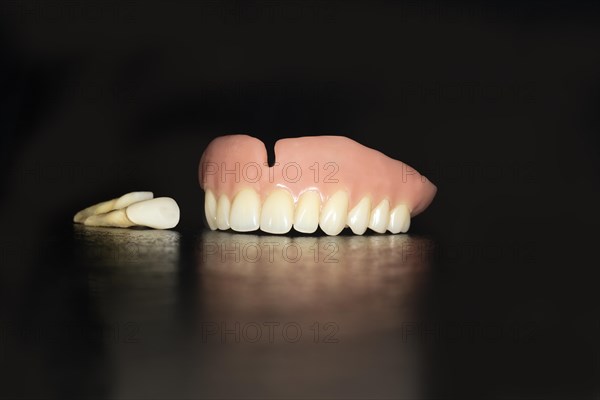 Denture upper jaw made of plastic with pulled teeth