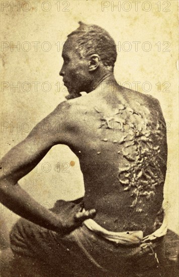Carte-de-visite of a formerly enslaved man identified only as Private Gordon. Gordon is seated