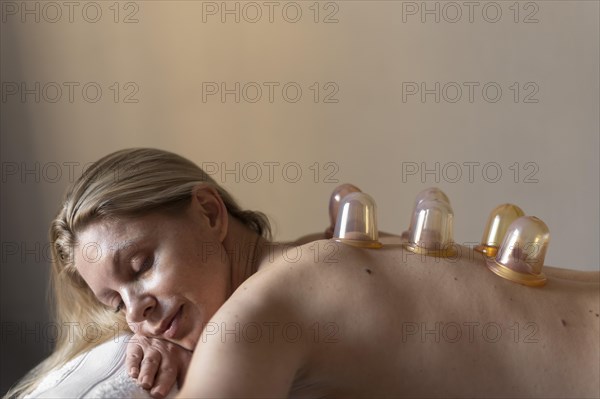 Medium shot woman experiencing cupping therapy