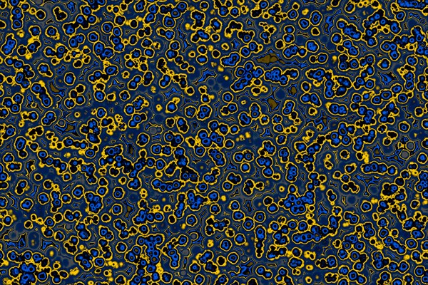 Shape of bacterial cell: cocci