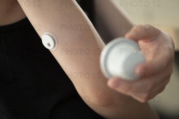 Child holding a setting aid for a glucose sensor, the sensor has been attached to the child's arm,