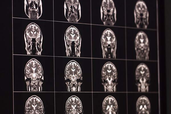 MRI scans of a brain in black and white, organised in a matrix, show different sections