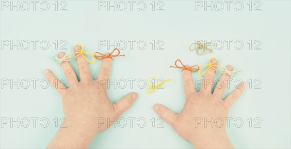 Alzheimer awareness day, dementia diagnosis, Parkinson disease, memory loss disorder, damaged
