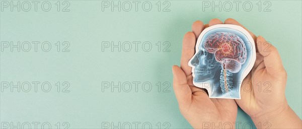Human brain x-ray, epilepsy, tumor, migraine headache attack, psychological pressure and stress,