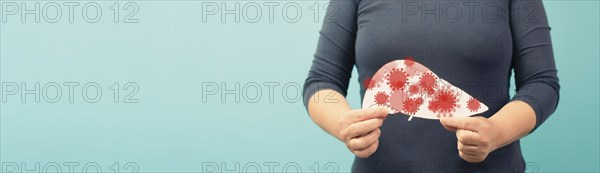 Liver organ infected with virus, world hepatitis day, diagnosis of cancer, cirrhosis health issue,