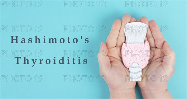 Hashimoto's thyroiditis, chronic lymphocytic disease, holding a thyroid organ, autoimmune symptoms,