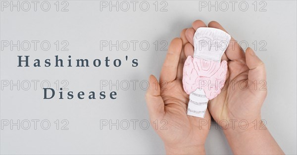 L Hashimoto's thyroiditis, chronic lymphocytic disease, holding a thyroid organ, autoimmune