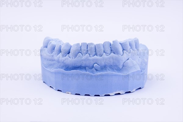 Denture impression of an upper jaw for dentures, dentist, dental impression